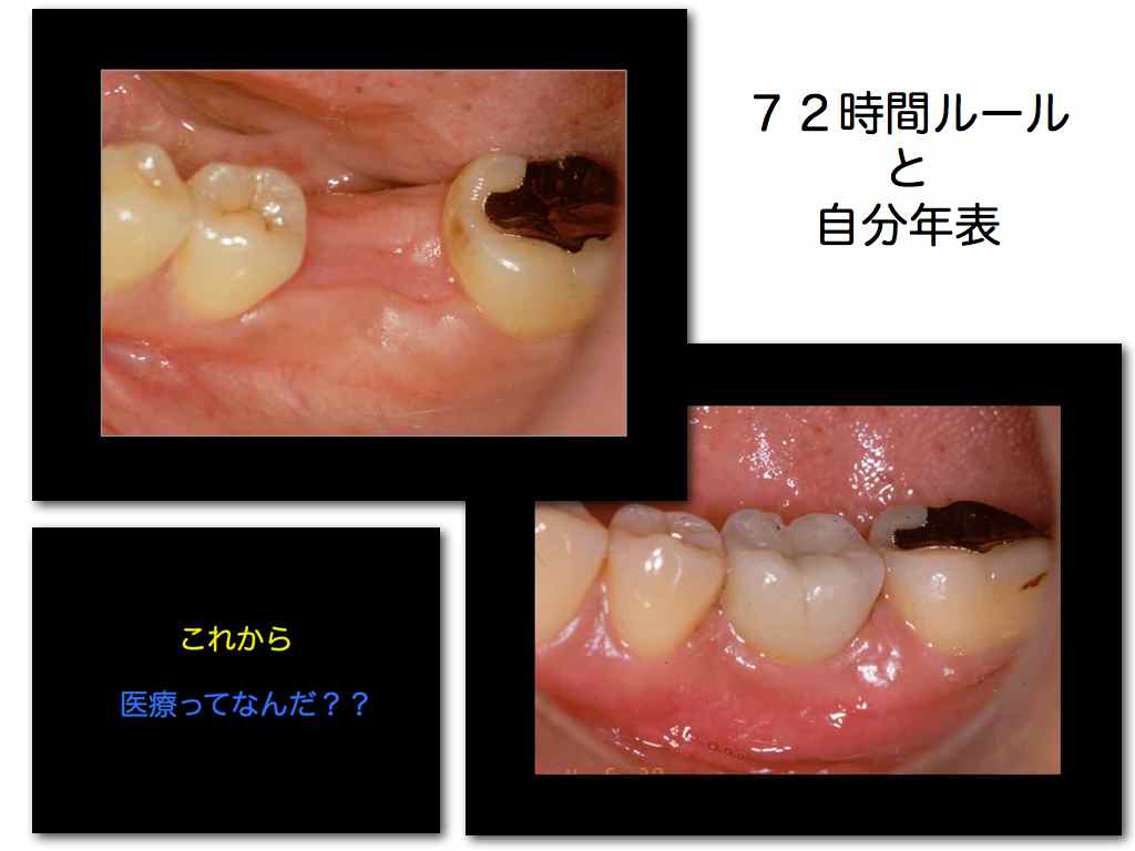 口腔インプラント学